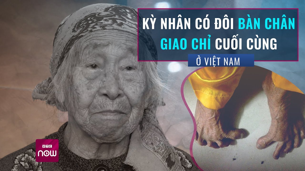 Gặp cụ bà cuối cùng có bàn chân Giao Chỉ: Vì sao bàn chân gốc của người Việt lại biến mất? | VTC Now