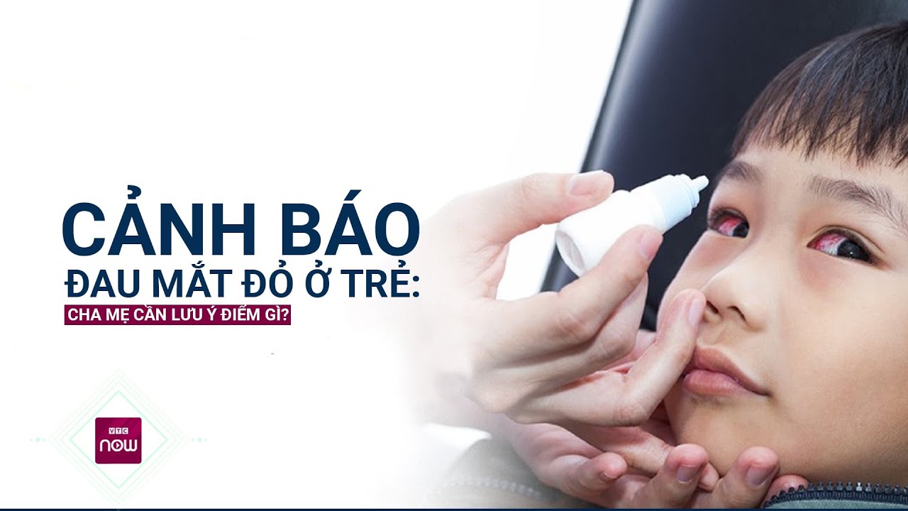 Cảnh báo đau mắt đỏ ở trẻ: Cha mẹ cần lưu ý điểm gì? | VTC Now