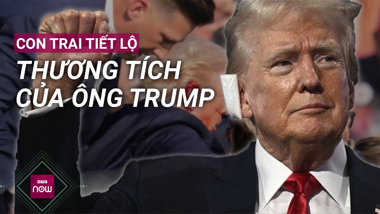 Con trai thứ hai tiết lộ điều gì về thương tích của cựu Tổng thống Donald Trump? | VTC Now