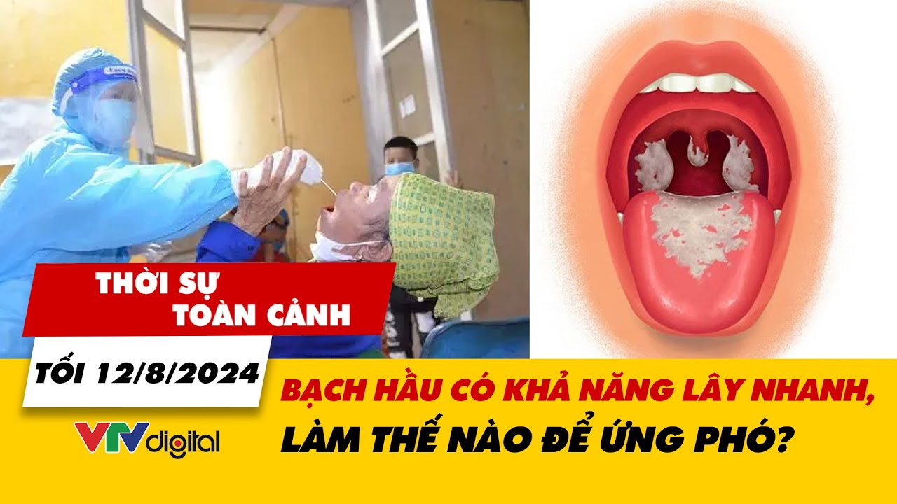 Thời sự toàn cảnh tối 12/8: Bạch hầu khả năng lây nhanh, làm thế nào để ứng phó? | VTV24