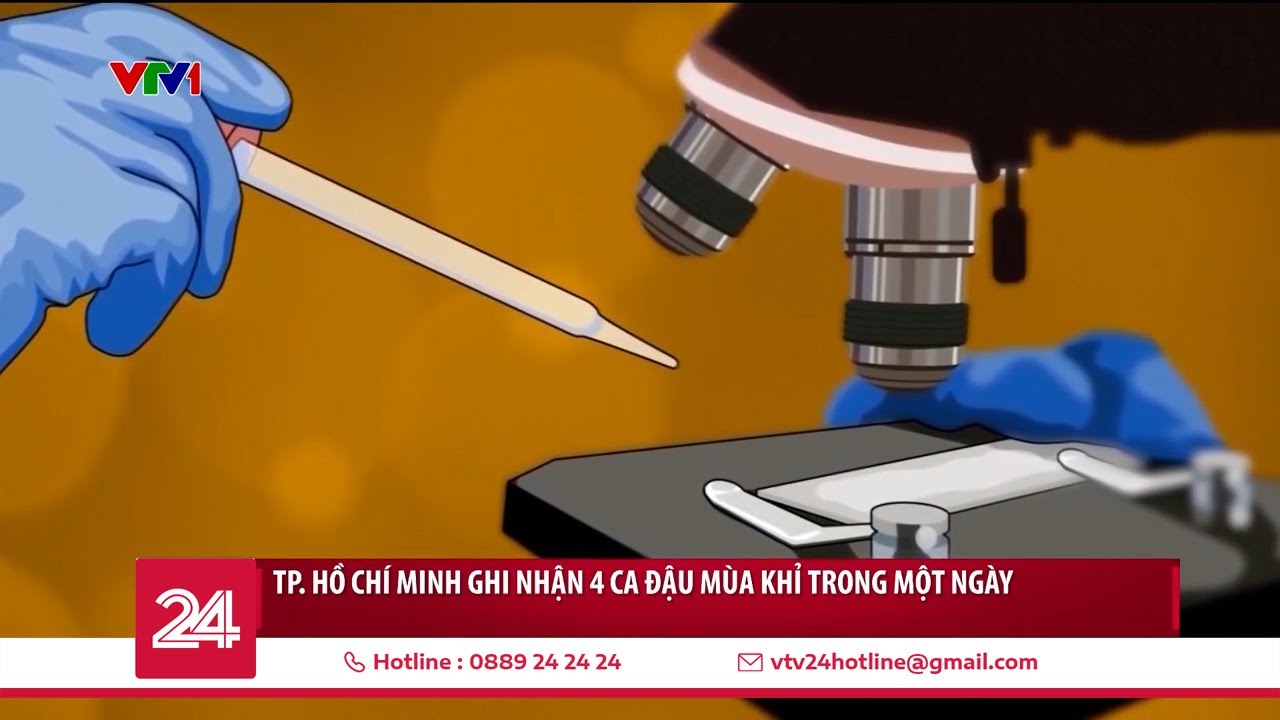 TP Hồ Chí Minh ghi nhận 4 ca đậu mùa khỉ trong một ngày | VTV24