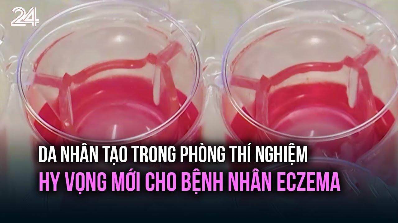 Da nhân tạo trong phòng thí nghiệm - hy vọng mới cho bệnh nhân Eczema | VTV24