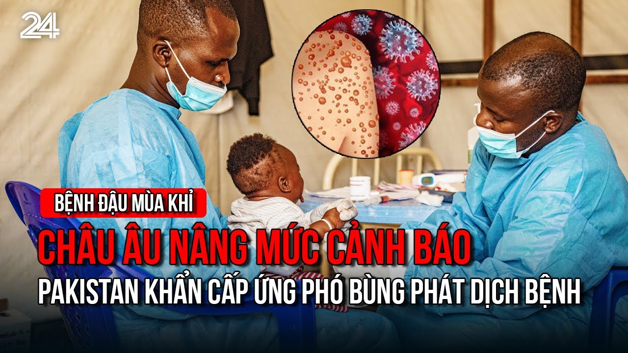 Bệnh đậu mùa khỉ: Châu Âu nâng mức cảnh báo, Pakistan khẩn cấp ứng phó  bùng phát dịch bệnh | VTV24