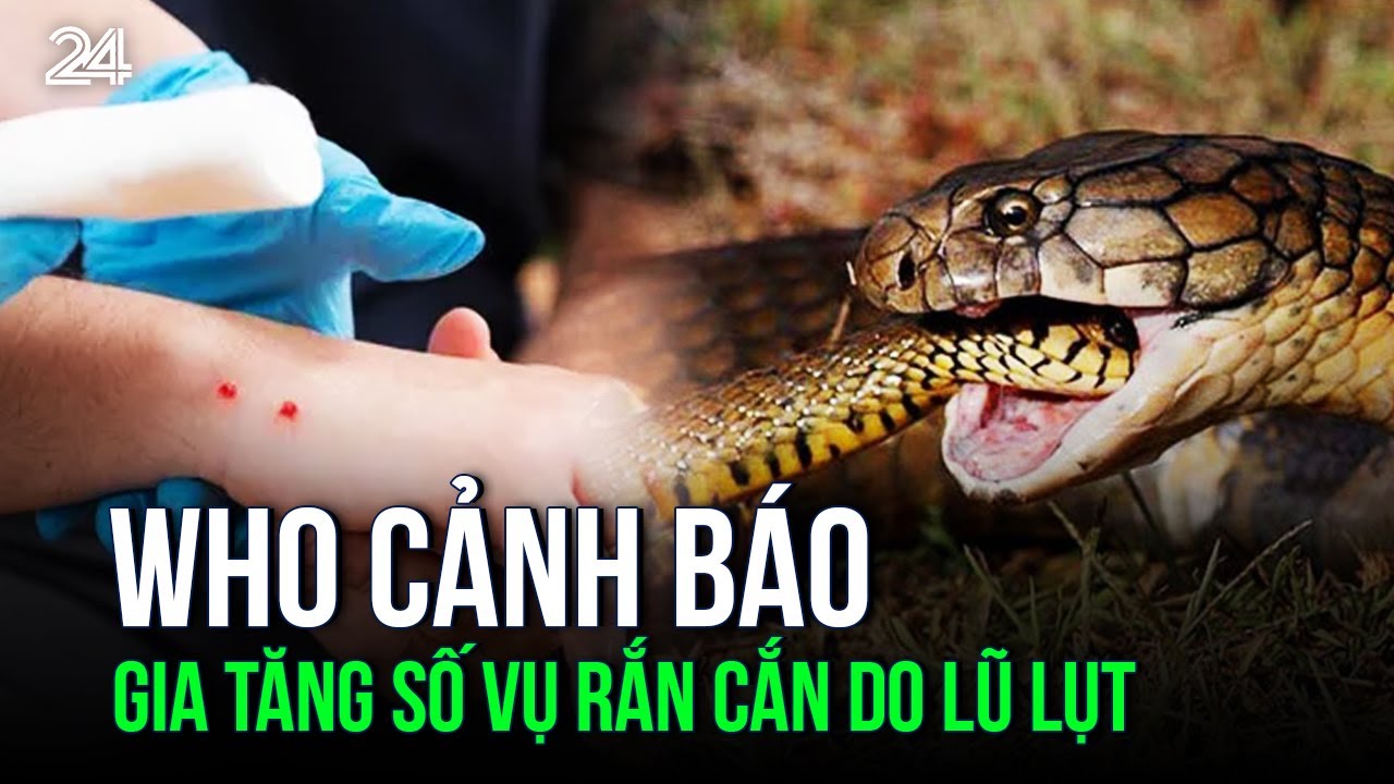 WHO cảnh báo gia tăng số vụ rắn cắn do lũ lụt | VTV24