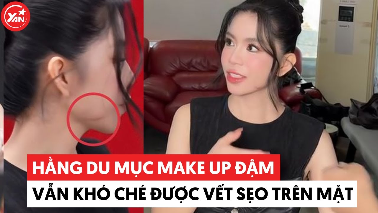 Hằng Du Mục make up đậm vẫn khó che sẹo trên mặt do chồng cũ “tương tác”