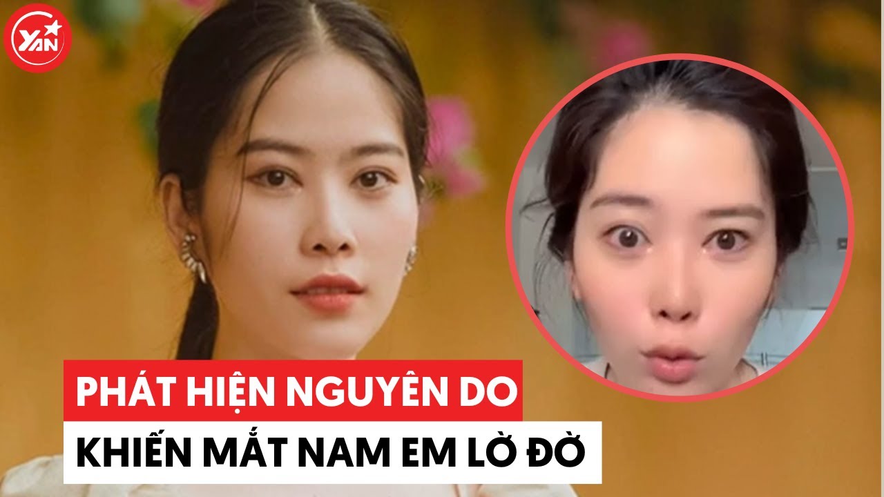 Phát hiện lý do khiến mắt Nam Em lờ đờ, chi nửa tỷ lại nhận kết đắng