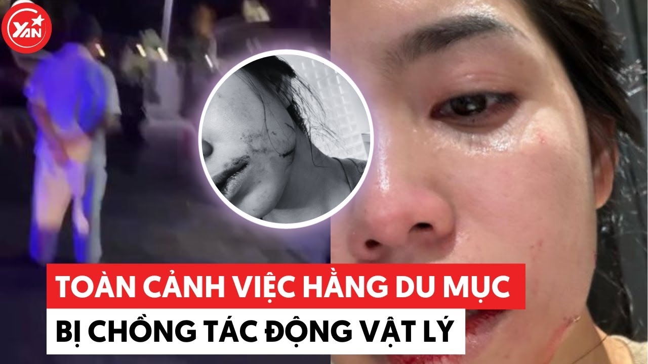 Toàn cảnh vụ Hằng Du Mục bị chồng tương tác để lại nhiều vết tích, vợ cũ cũng gặp cảnh tương tự