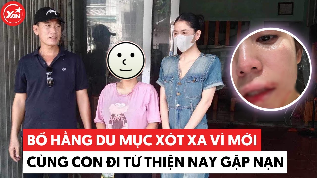 Bố Hằng Du Mục xót xa vì mới cùng con đi từ thiện nay gặp nạn, bất lực vì ở xa