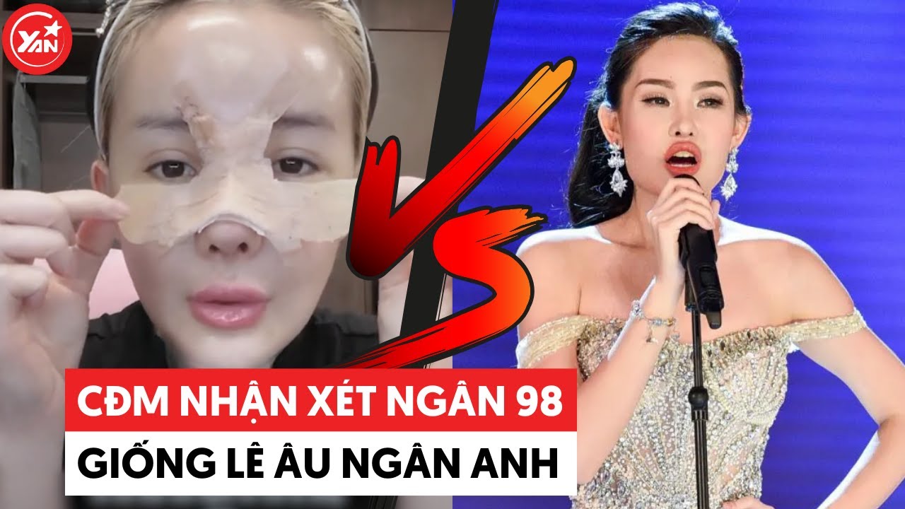 Ngân 98 “đập hộp” mặt mới, chưa thấy khen xinh nhưng fan đã ồ ạt nhận xét giống Lê Âu Ngân Anh