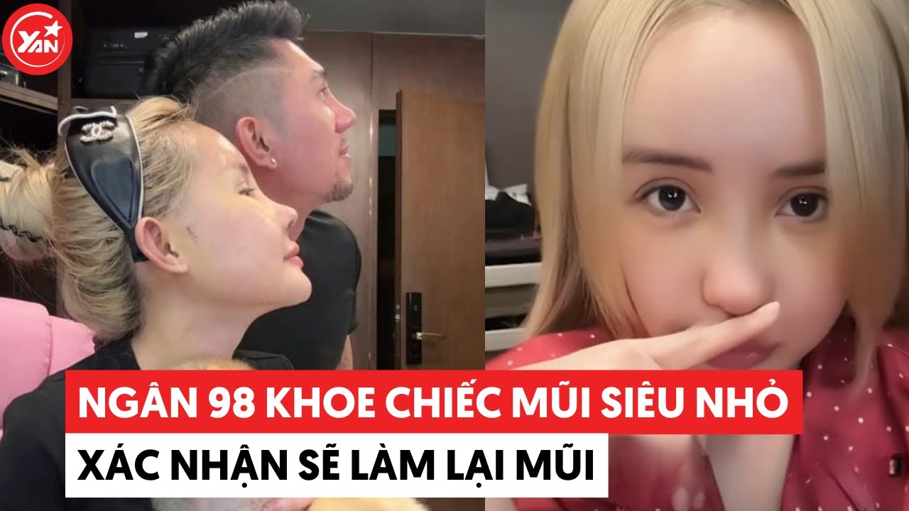 Ngân 98 khoe chiếc mũi siêu nhỏ, xác nhận phải làm lại mũi trong tương lai vì bị co rút