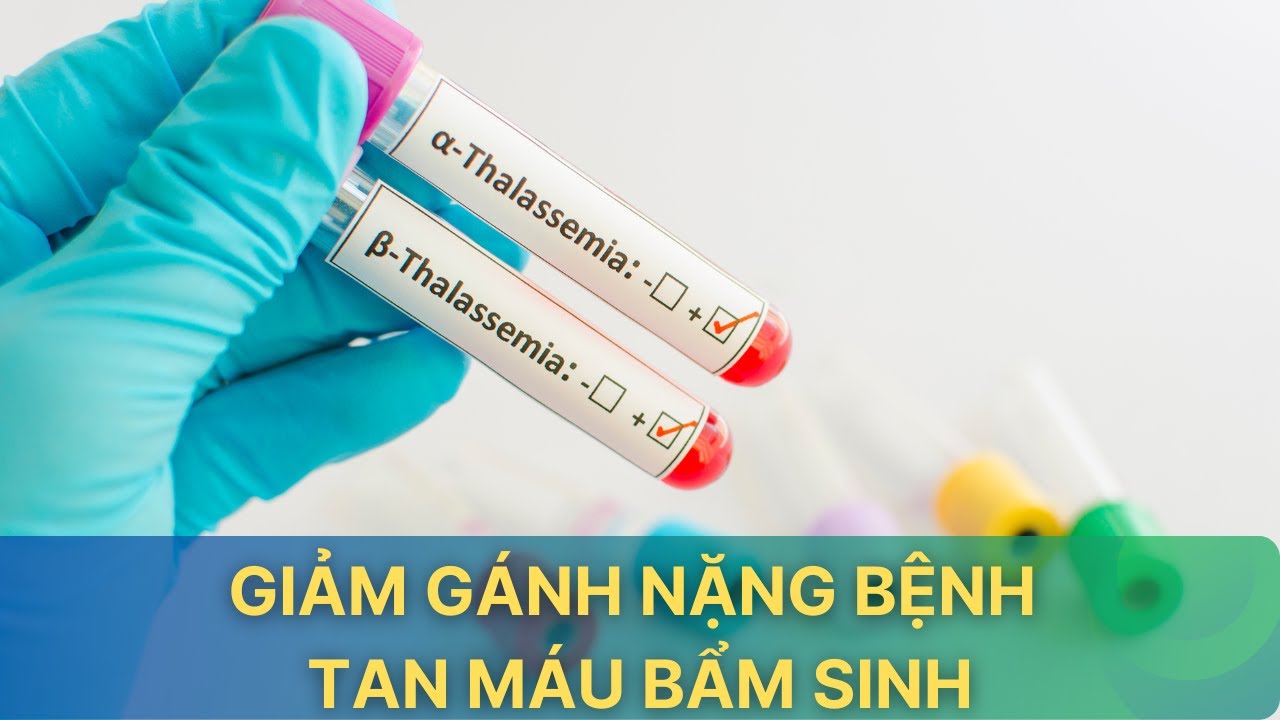 Gánh nặng do bệnh tan máu bẩm sinh và các phòng tránh| VTV Sức khỏe