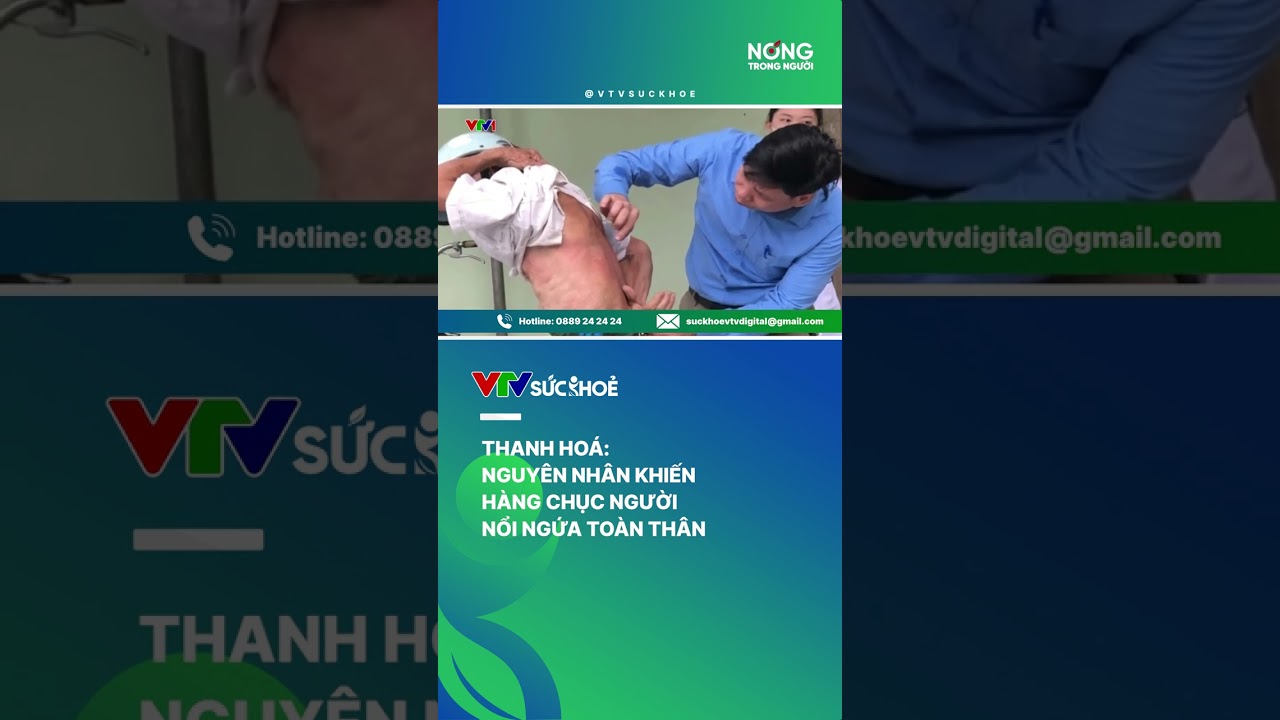 Nguyên nhân khiến hàng chục người ở Thanh Hóa nổi ngứa toàn thân| VTV Sức khoẻ