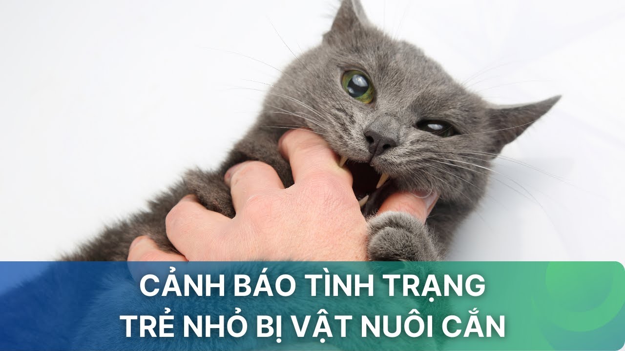 Cảnh báo tình trạng trẻ nhỏ bị vật nuôi cắn| VTV Sức khỏe