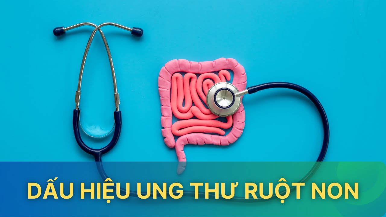 Cảnh báo các dấu hiệu ung thư ruột non| VTV Sức khỏe