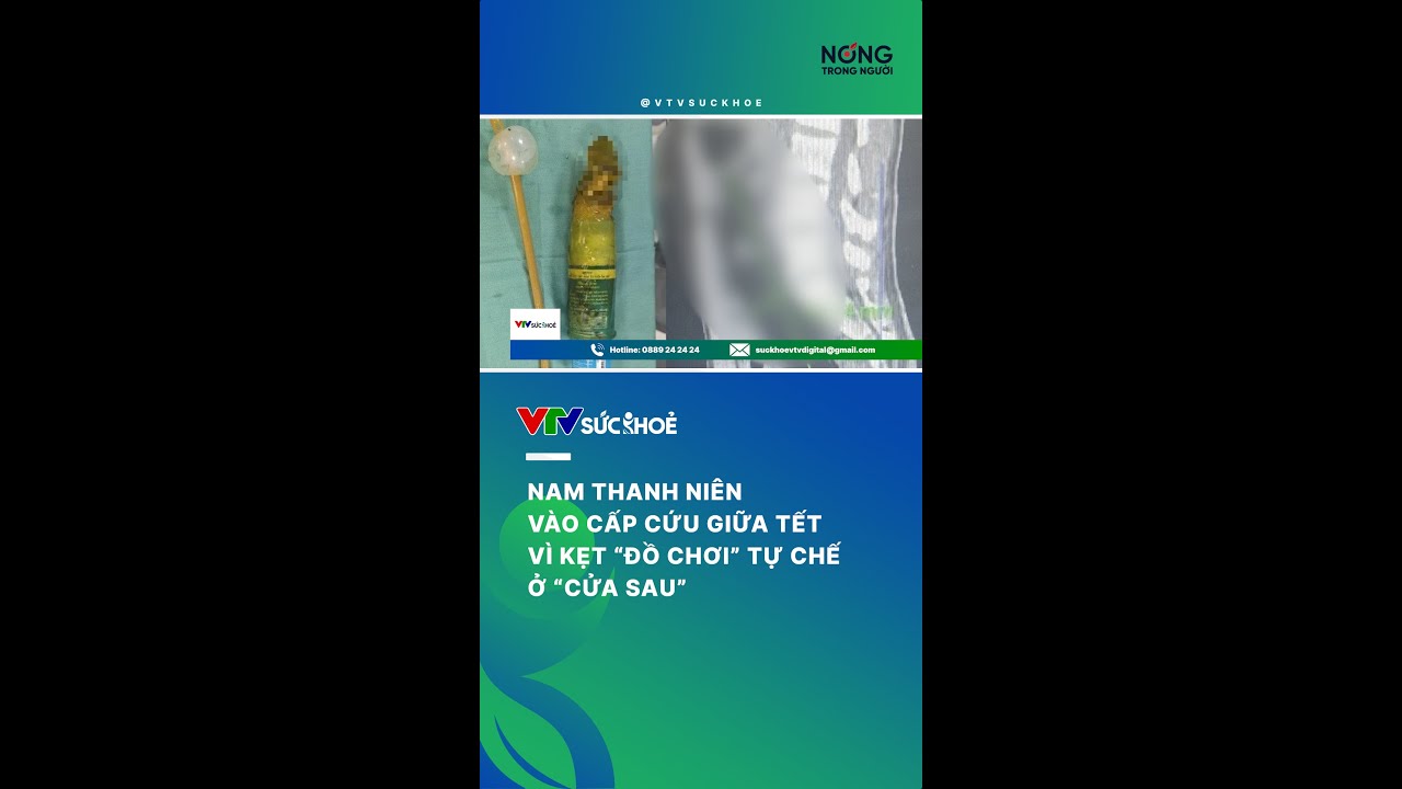 Kẹt "đồ chơi tự chế" ở "cửa sau", nam thanh niên phải vào cấp cứu giữa Tết | VTV Sức khoẻ