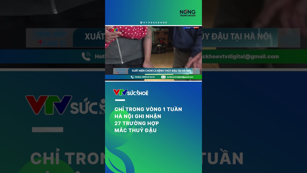 Chỉ trong một tuần, Hà Nội ghi nhận 27 trường hợp mắc thuỷ đậu| VTV Sức khoẻ