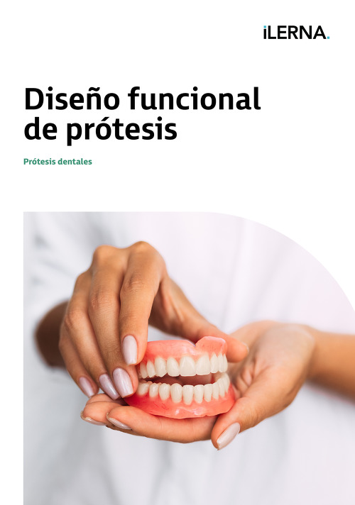 Material Didáctico Módulo 2: Diseño funcional de prótesis