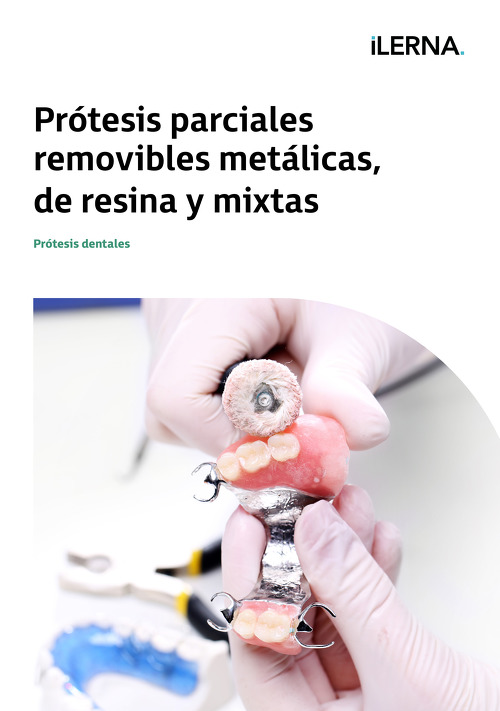 Material Didáctico Módulo 6: Prótesis parciales removibles metálicas, de resina y mixtas