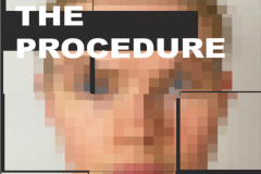 The Procedure