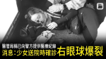 醫管局稱已向警方提供醫療紀錄 消息：爆眼少女送院時確診右眼球爆裂