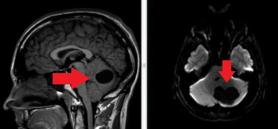 medical scan images for Ryan's tumor