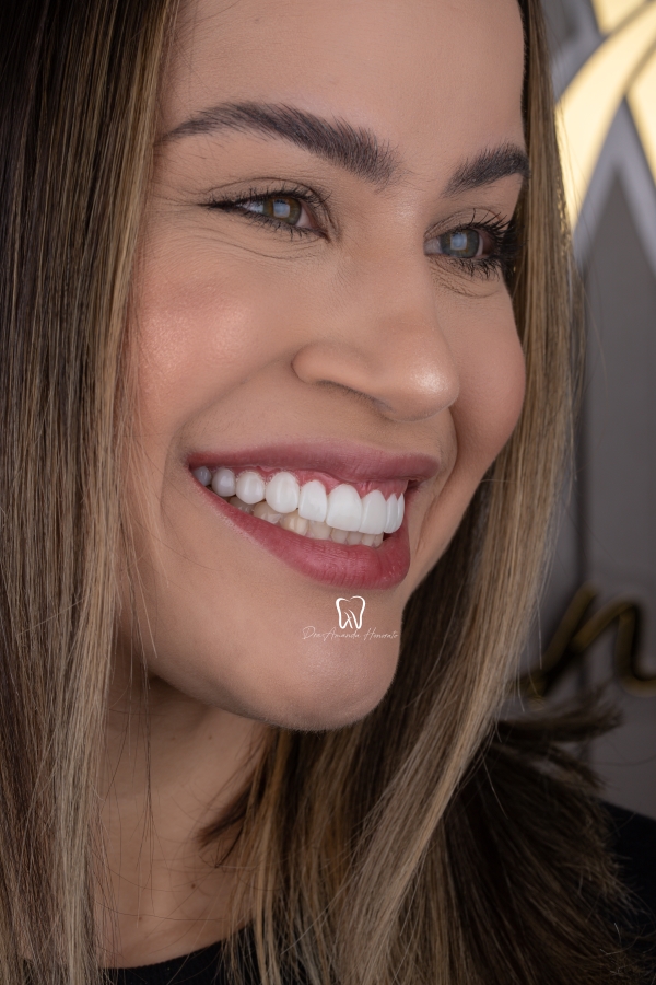 Debora Sorrindo