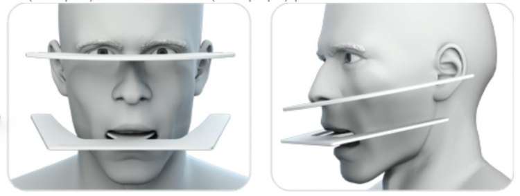 POP Fox Ruler | DentaCarts | Dental Cart