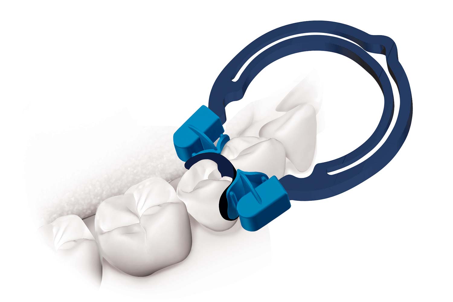 Polydentia myQuickmat Forte Kit | DentaCarts | Dental Cart