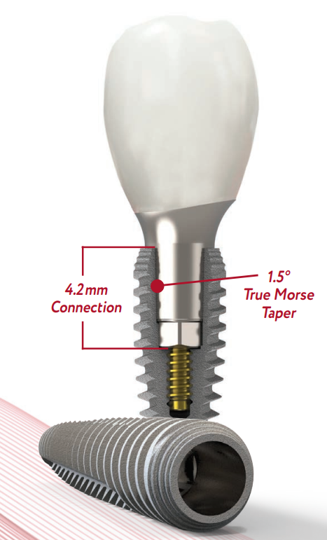 Argon K3Pro Implant Packages | DentaCarts | Dental Cart