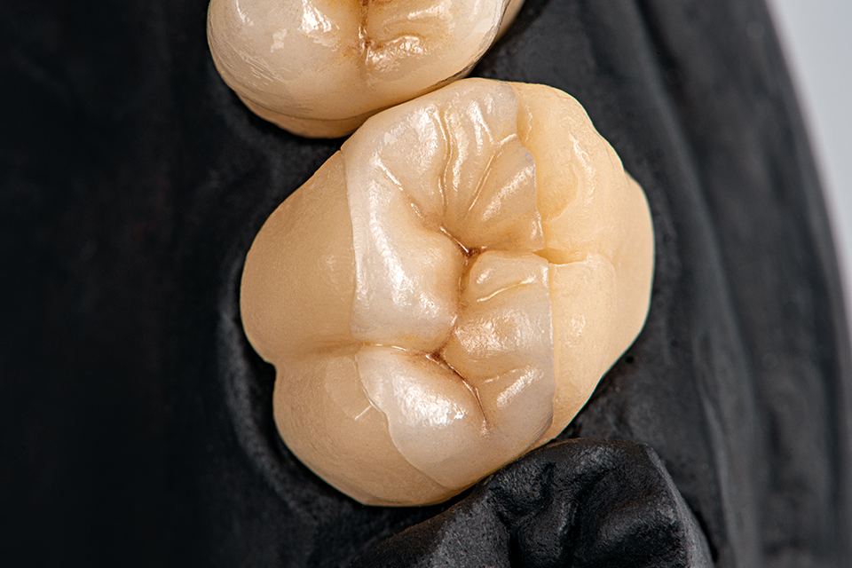 Sagemax PressCeramic Ingots | DentaCarts | Dental Cart