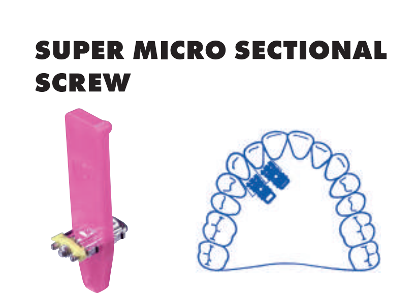 Leone Super Micro Sectional Screws | DentaCarts | Dental Cart