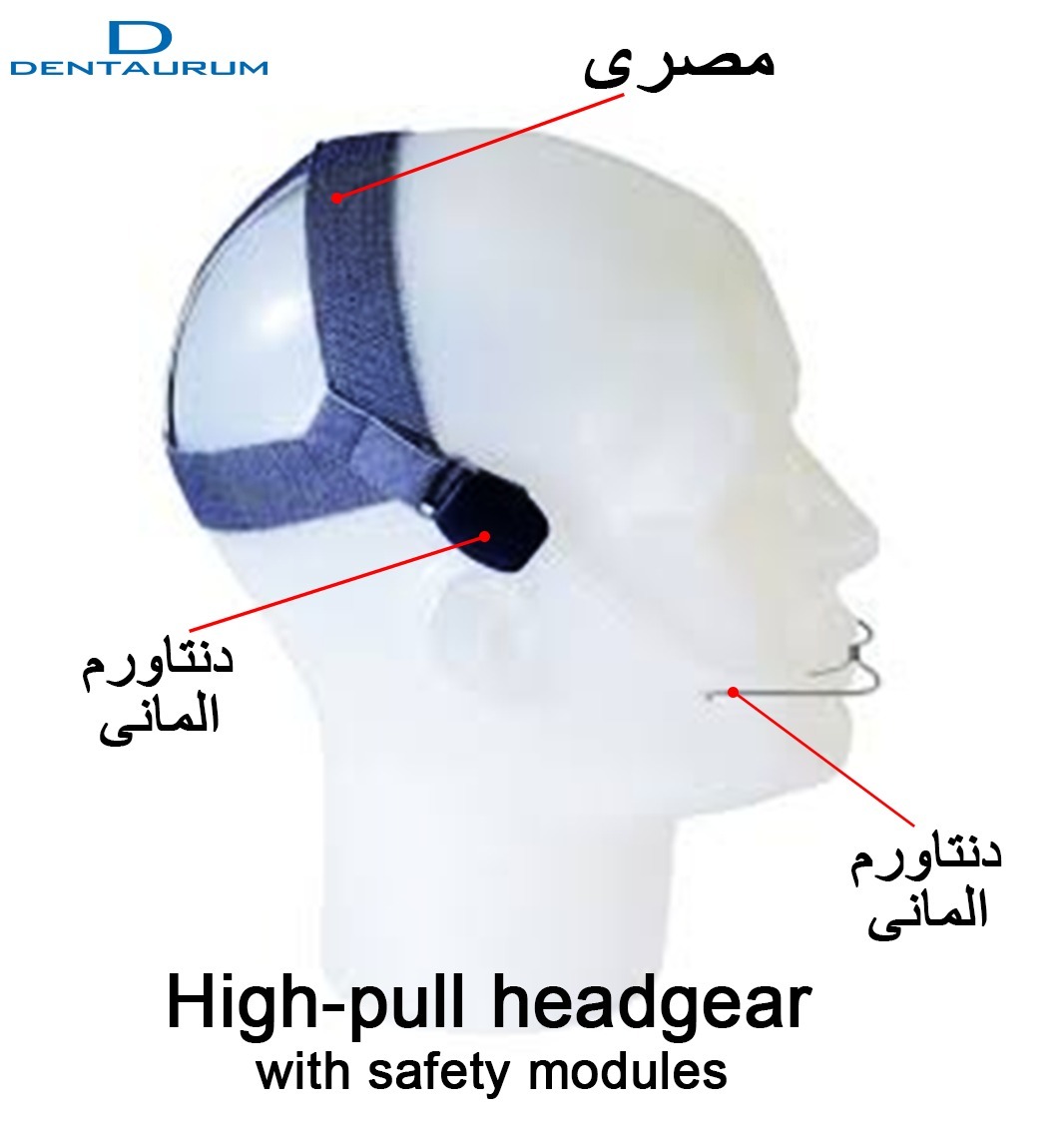 Dentaurum High-Pull Headgear With Safety modules | DentaCarts | Dental Cart