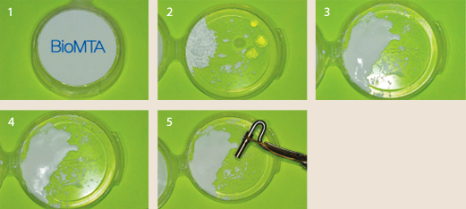 Bio MTA Retro MTA | DentaCarts | Dental Cart