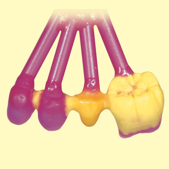 Bredent Wax Pattern Sticks Red 4.0x115mm 250g | DentaCarts | Dental Cart