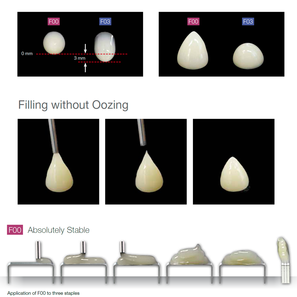 Shofu Beautifil Flow Plus  (injectable composite) | DentaCarts | Dental Cart