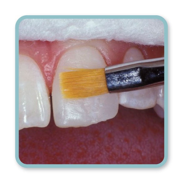 ENA Composite Brush | DentaCarts | Dental Cart