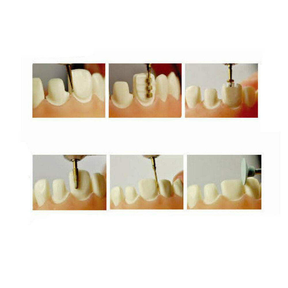 Toboom Preparation Teeth Kit for Porcelain Veneers 8pcs/Kit | DentaCarts | Dental Cart