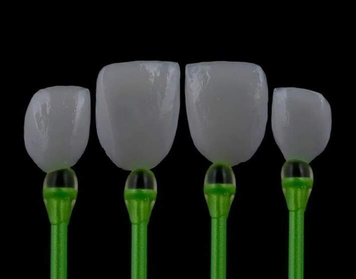 Denu Stick Free Tips For Veneer - 16pcs | DentaCarts | Dental Cart