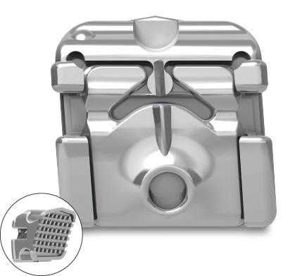 Ortho Organizers Carriere SLX Self-Ligating Brackets MBT (.022) (5x5) Set | DentaCarts | Dental Cart