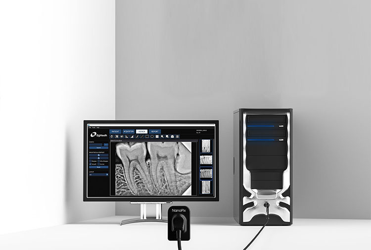 Eighteeth Nanopix - Intraoral X-Ray Sensor | DentaCarts | Dental Cart