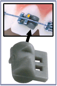 Ortho Organizers Rotation Wedge Standard Grey | DentaCarts | Dental Cart