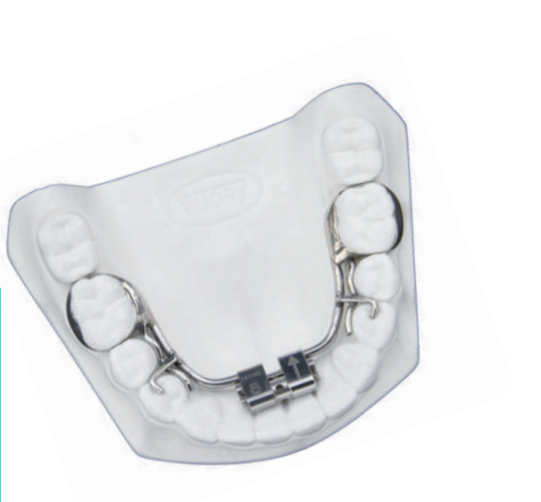 Leone Rapid Expander For Lower Arch 8mm | DentaCarts | Dental Cart