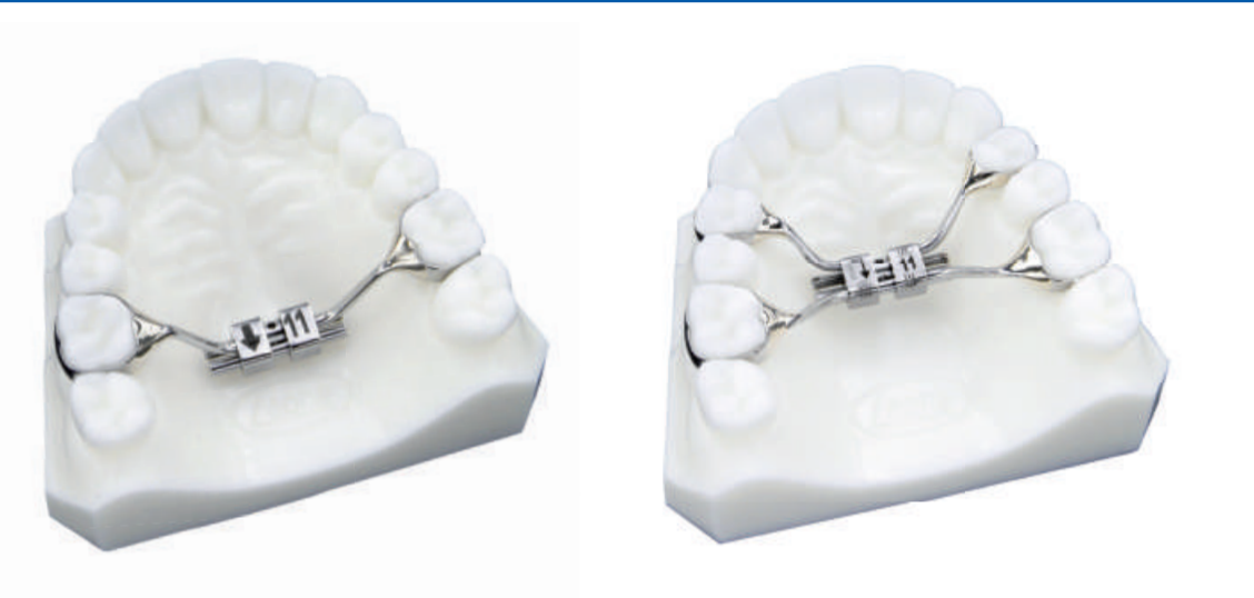 Leone Baby Rapid Expander | DentaCarts | Dental Cart