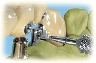 Bredent Diatit MultiDrill | DentaCarts | Dental Cart