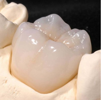 STL Dental Solution  ( DENTAL LAB)  ( CAD/CAM Restorations) | DentaCarts | Dental Cart