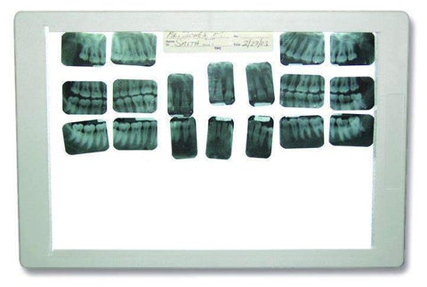 TPC  X-ray Viewer | DentaCarts | Dental Cart