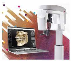 Carestream CS 8200 3D System | DentaCarts | Dental Cart