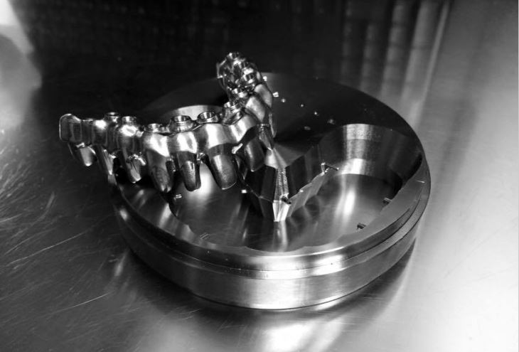 STL DENTAL SOLUTION ( DENTAL LAB) ( IMPLANTS Full Arch ) | DentaCarts | Dental Cart