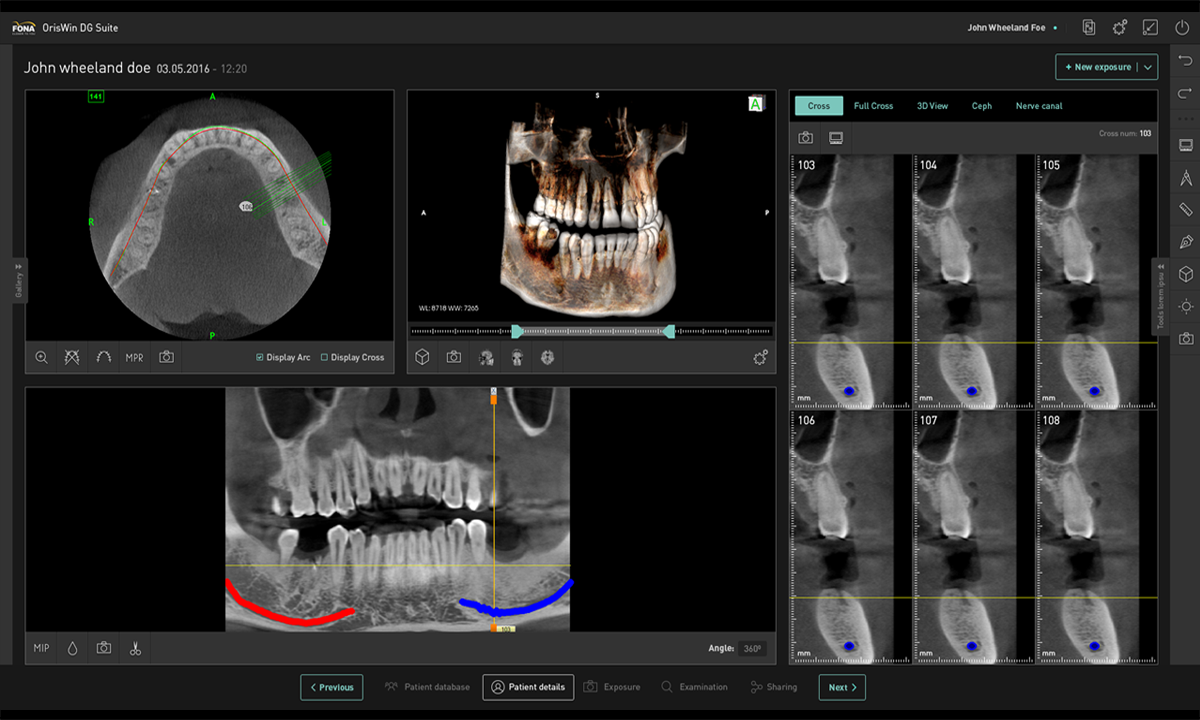 Fona Stellaris 3D | DentaCarts | Dental Cart
