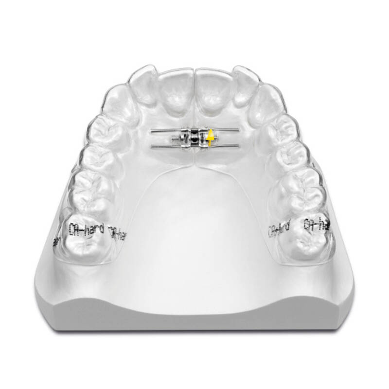 Scheu Vector 45 Expansion screw 1pcs | DentaCarts | Dental Cart